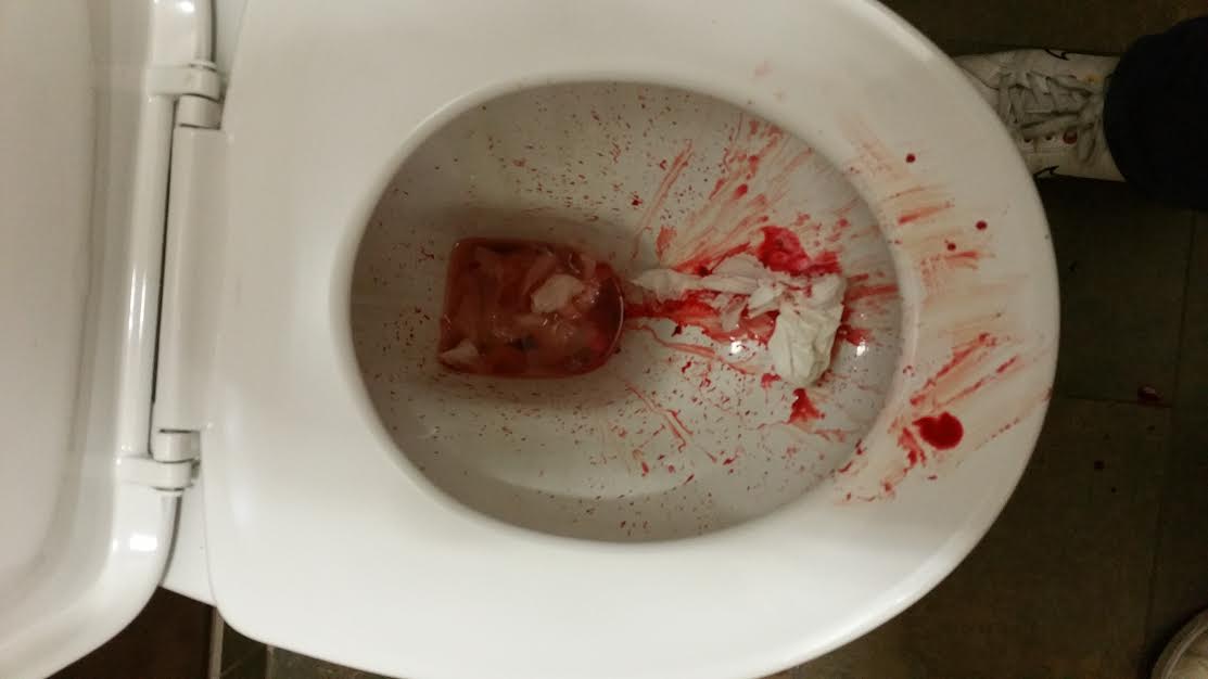 EXCLUSIVE - Ex-Squaddie Who Urinates Blood Told He is Fit to Work Can You Poop In A Macerator Toilet