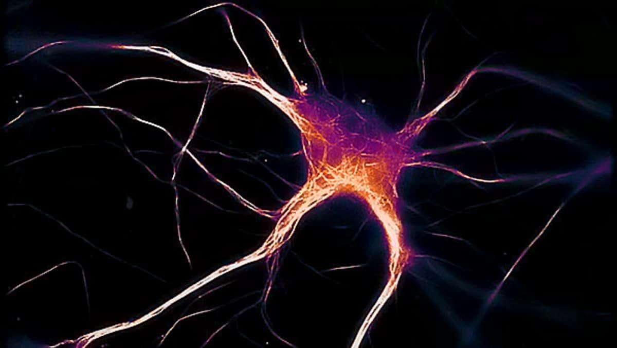 Cure for Alzheimer’s disease could be on the horizon