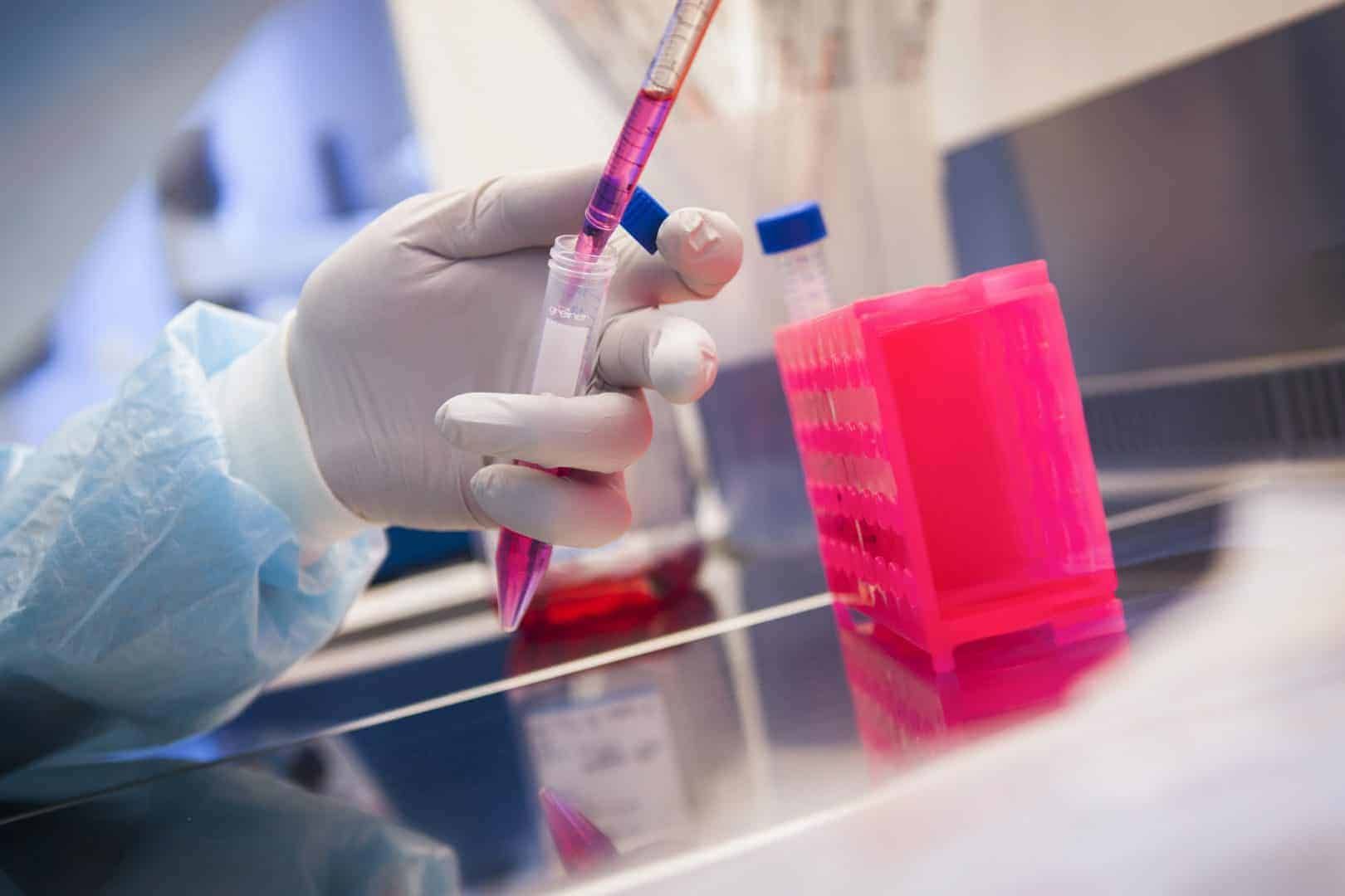 UK researchers screening volunteers for coronavirus vaccine trial