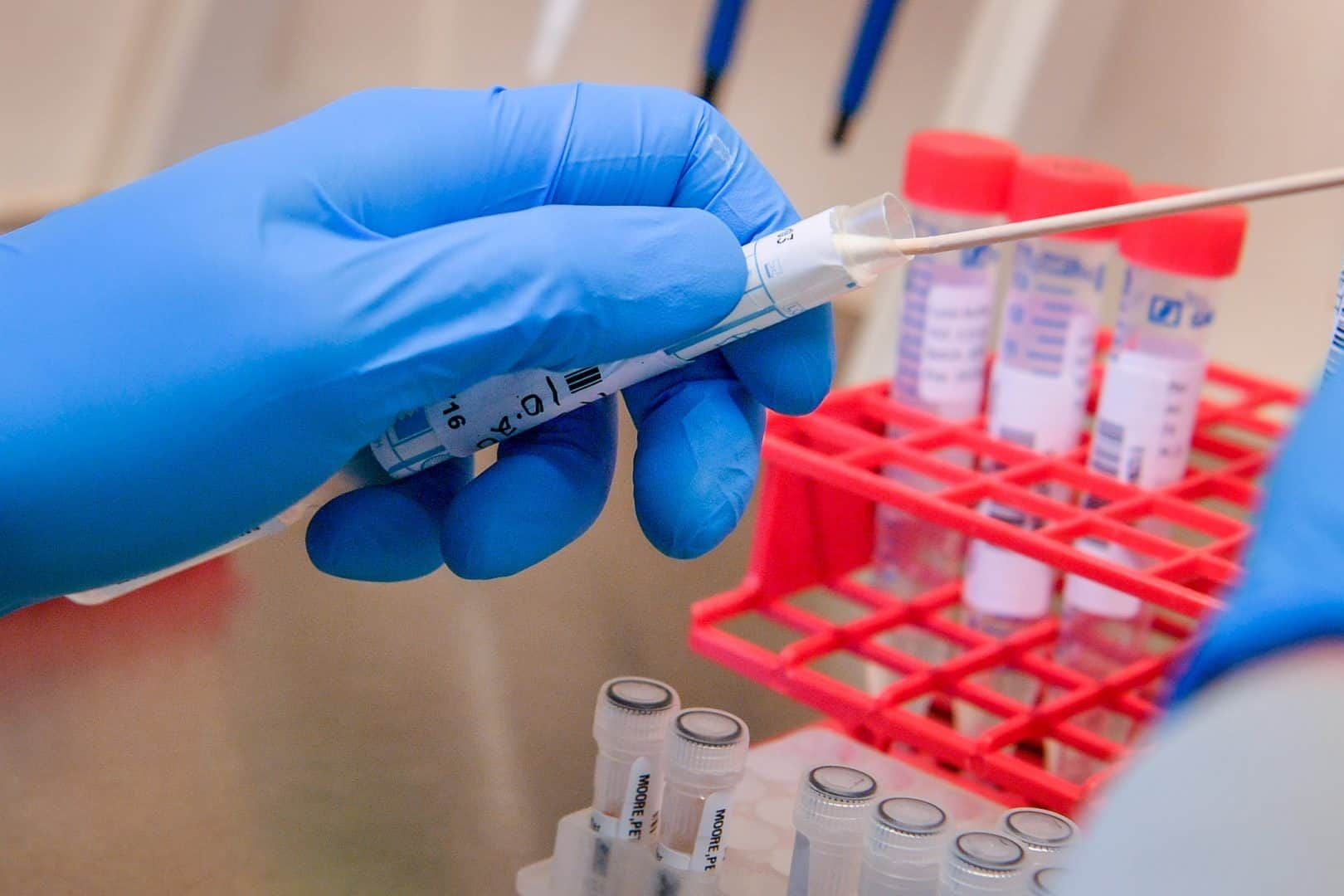 Coronavirus UK – ‘Accurate’ £6 Covid-19 test has only attracted ‘tentative’ Government interest