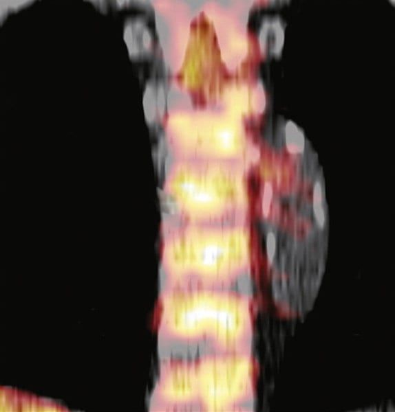 swns_stress_scans_01