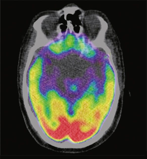 swns_stress_scans_06