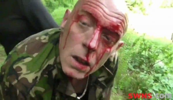Vicious brawl between huntsmen & protesters leaves activist with broken skull but police take no action