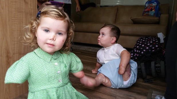 Watch – Toddler who lost all her limbs to meningitis takes her first steps