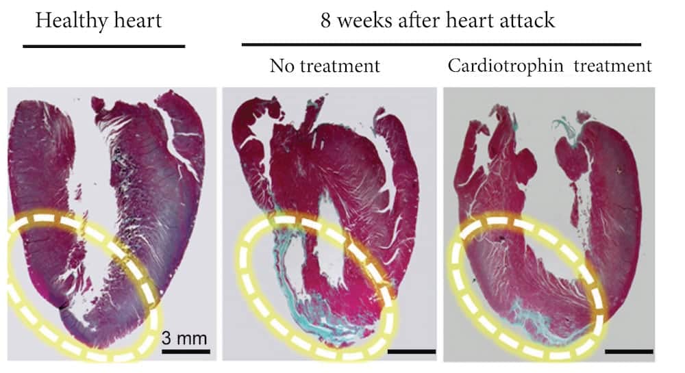 ‘Exercise pill’ that boosts blood flow could revolutionise the lives of heart failure patients