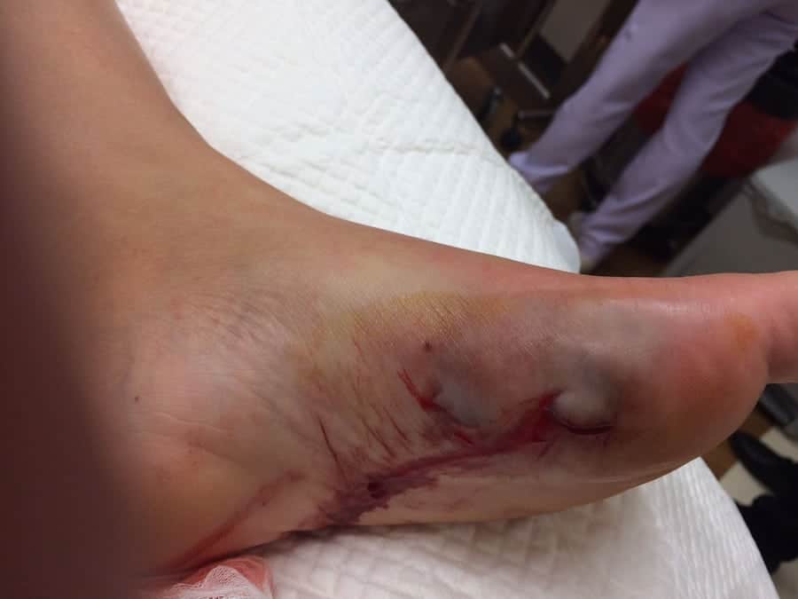 A mum is lucky to be alive after she was attacked by a stingray – and stabbed in the FOOT
