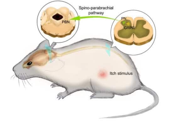 The source of the itch sensation has been discovered by scientists