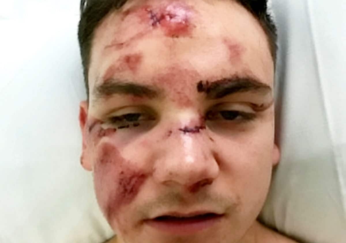 Student has lucky escape when fell on tracks during fit