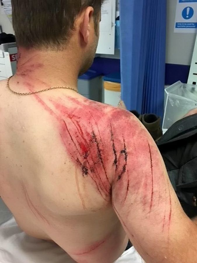 A taxi driver has described how he almost died after being trampled by an angry herd of rampaging cows as he was out walking his dog.  Adam Delves, 38, was left badly injured after he was repeatedly stamped on and tossed into the air by the stampeding animals on a public pathway.