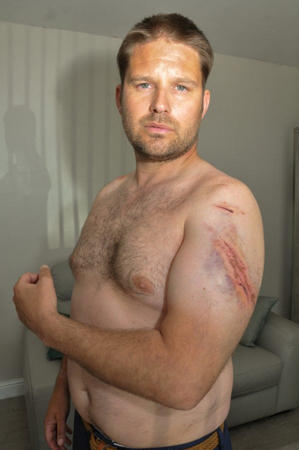 A taxi driver has described how he almost died after being trampled by an angry herd of rampaging cows as he was out walking his dog.  Adam Delves, 38, was left badly injured after he was repeatedly stamped on and tossed into the air by the stampeding animals on a public pathway.