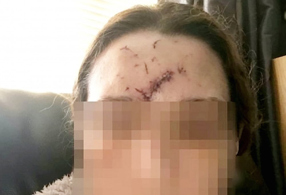 Woman, 39, scarred for life after being glassed by football hooligans in pub at Wolverhampton Wanderers vs Aston Villa