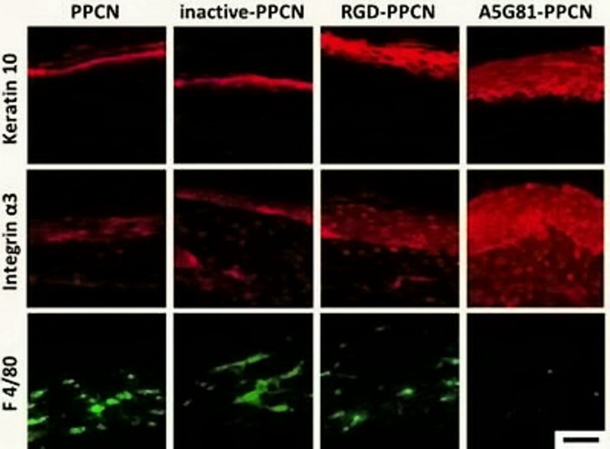 Regenerative bandage ‘speeds up healing in patients with diabetes’