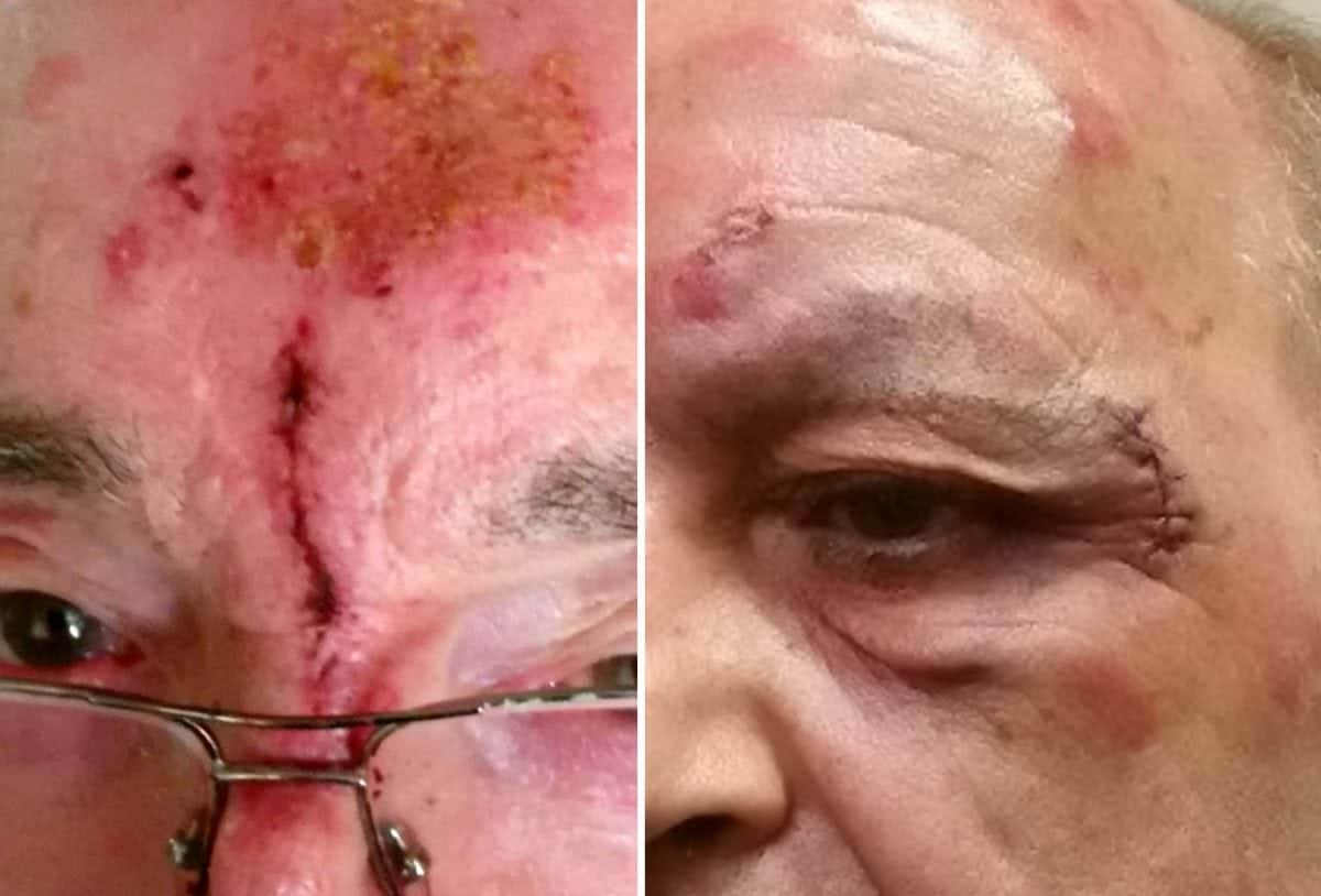 Police hunting thugs who attacked two elderly men in their homes after posing as cops