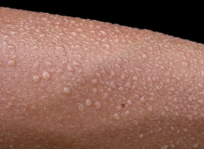 A skin patch that measure how stress you are by your sweat has been developed by scientists.