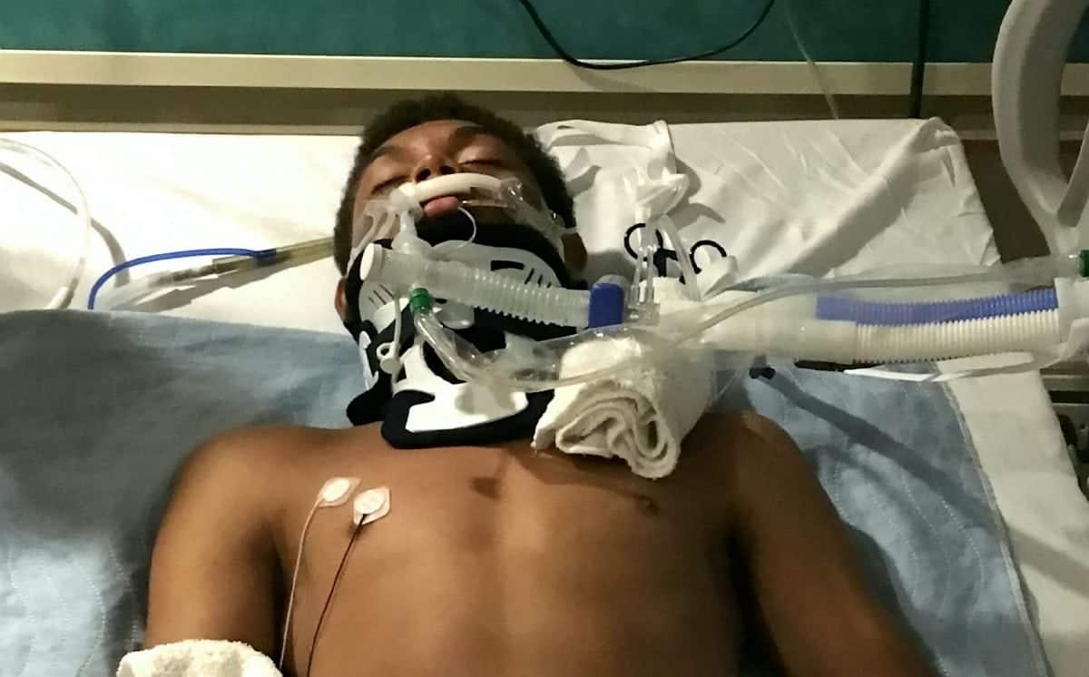 Lucky teenager who was struck by lightning may have survived thanks to his skateboard