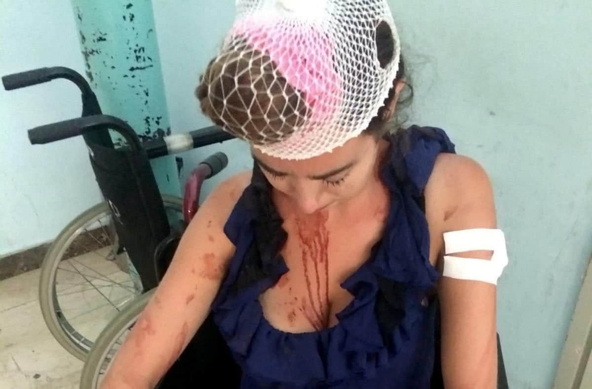 British student beaten with metal bar after refusing to pay more money for holiday hostel