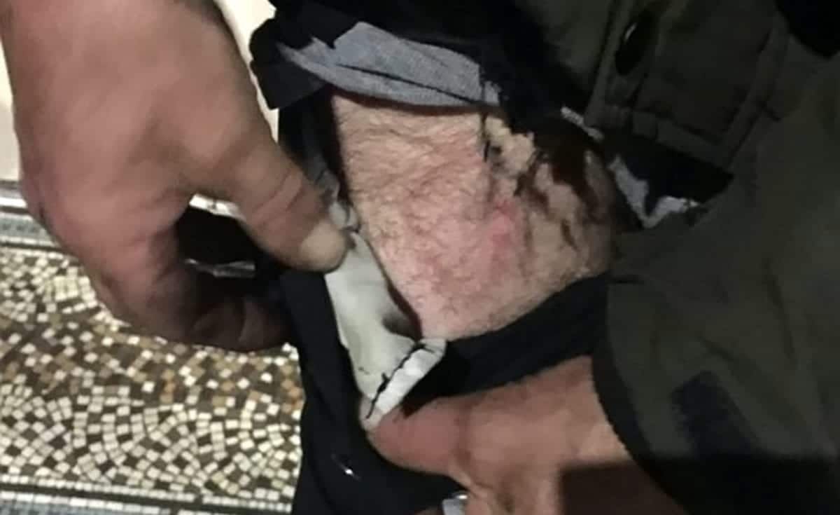 Yobs stick firework in homeless veteran’s pocket