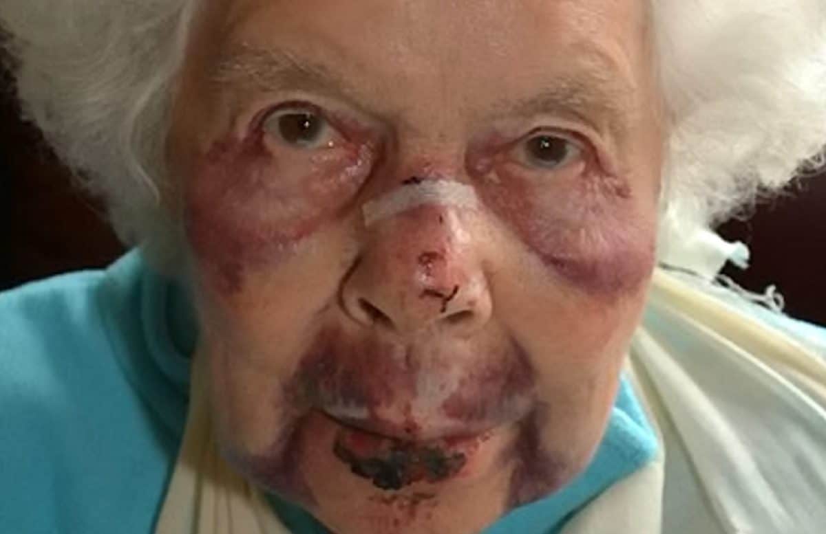 Police release shocking images of 88-year-old mugged in broad daylight