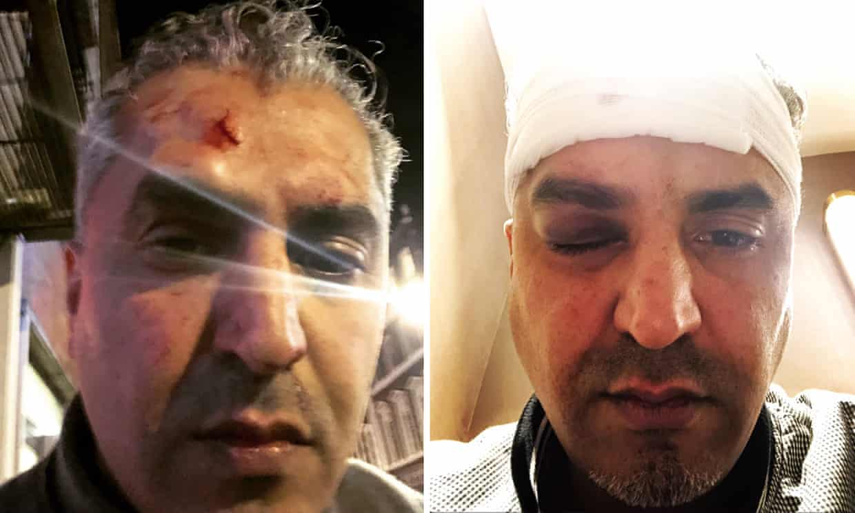 Radio presenter battered by “racist coward” in Central London