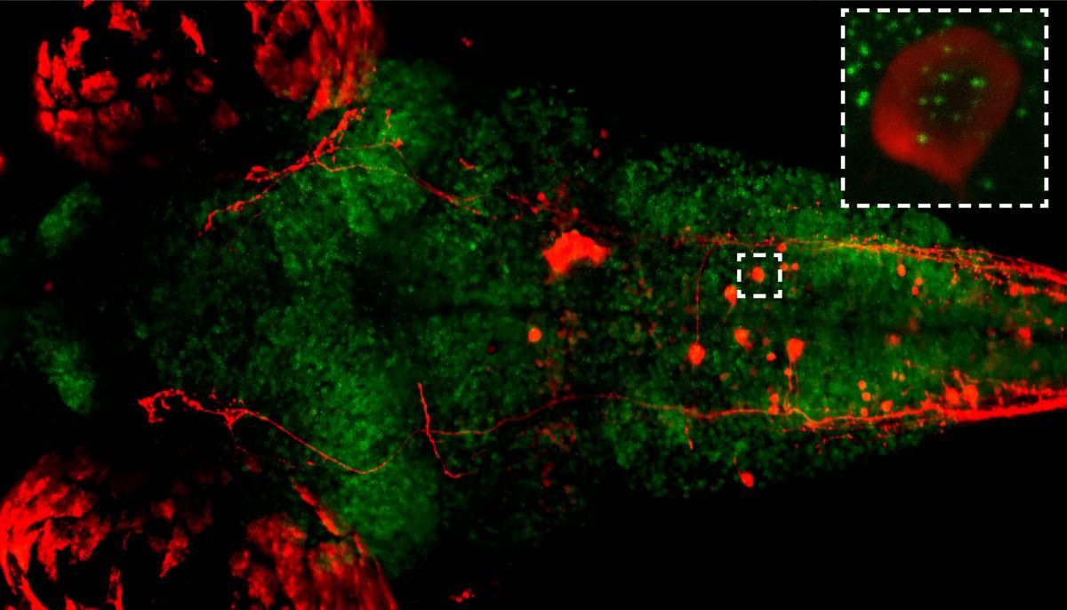 Sleep allows nerve cells to perform vital “maintenance” tasks, suggests study