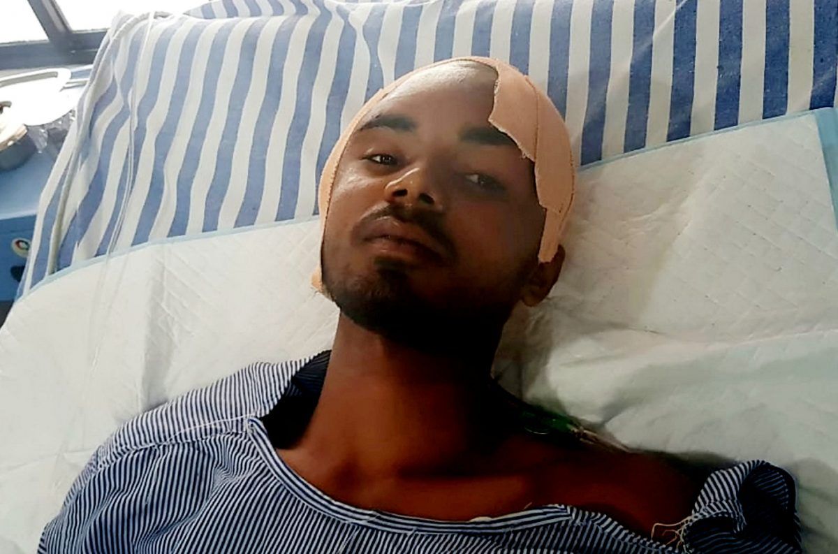 Construction worker Sanjay Bahe fell down a well and an iron rod pierced straight through his head. (c) SWNS