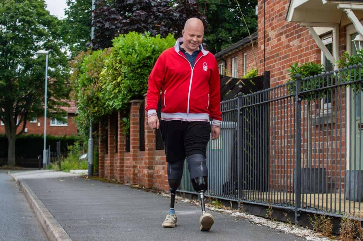 Nottingham Forest fan back on feet after having both legs amputated & made it to game