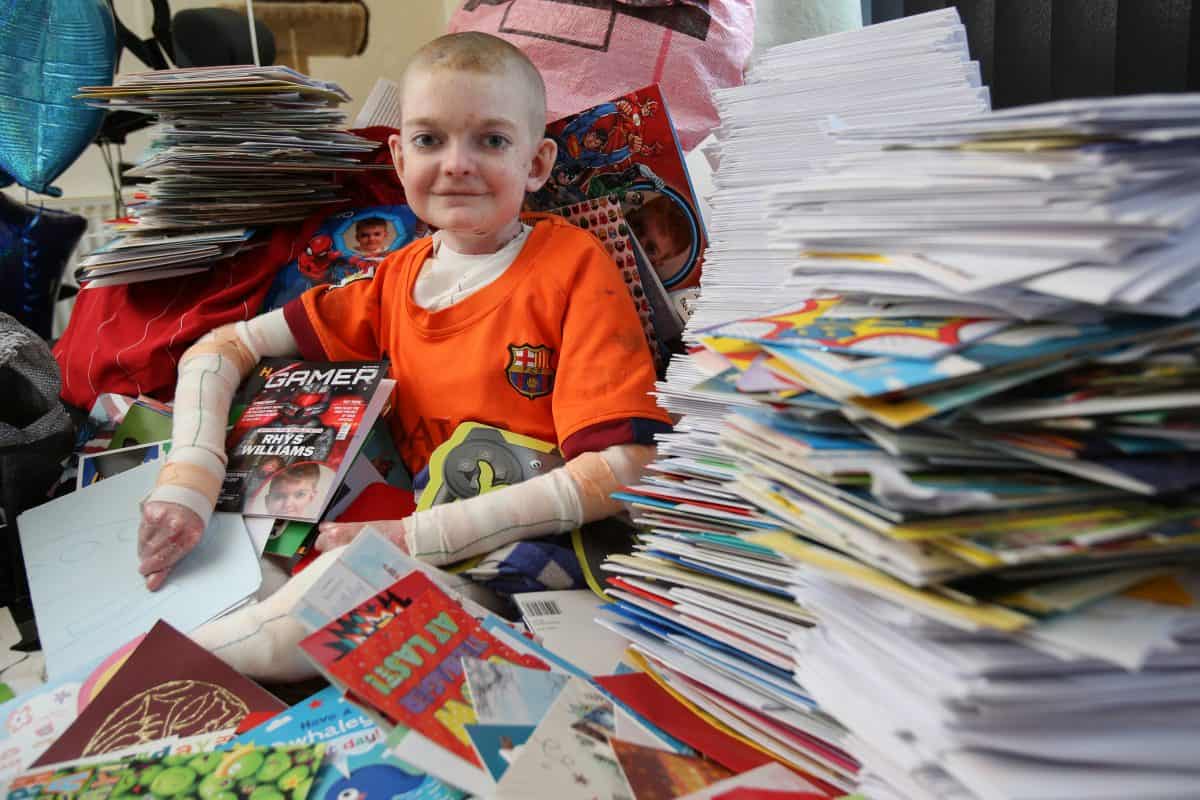 Schoolboy with skin condition surrounded by 10,000 birthday messages from across the world after telling his mother: ‘I’ve had enough of life’