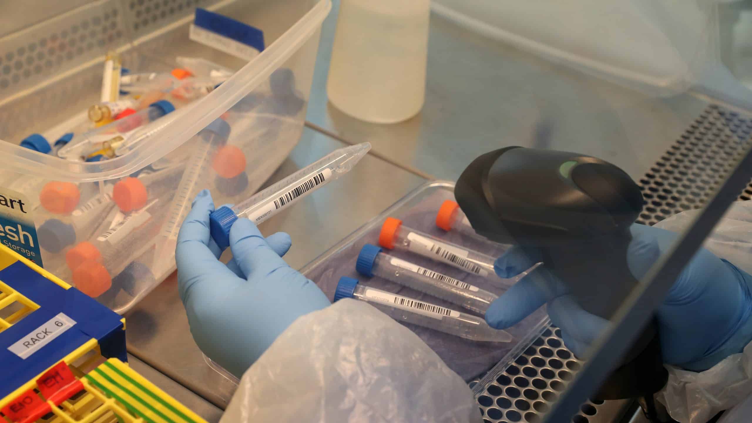 Coronavirus breakthrough as ‘100% accurate’ antibody test developed
