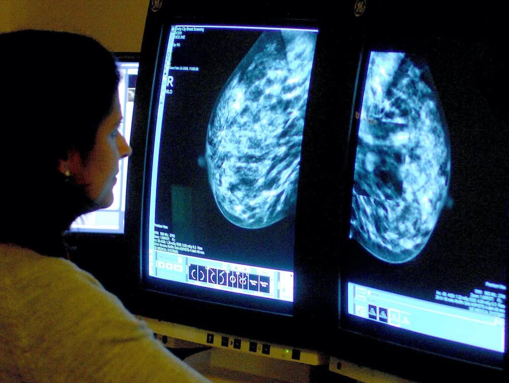 UK could experience 35,000 excess cancer-related deaths due to Covid-19