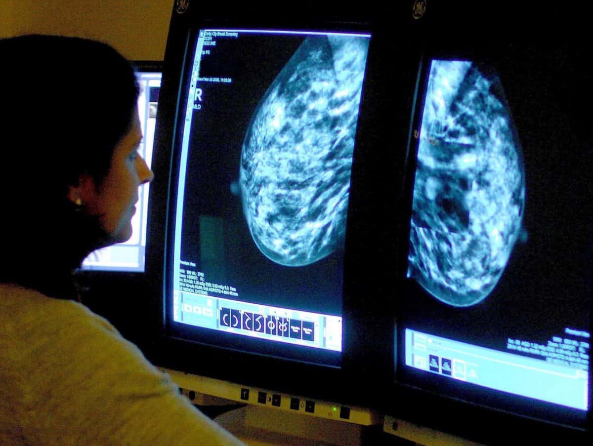 Embargoed to 0001 Wednesday November 20 File photo dated 15/06/06 of a consultant analyzing a mammogram. Simple arthritis drugs used on the NHS could help stop breast cancer spreading, research suggests.