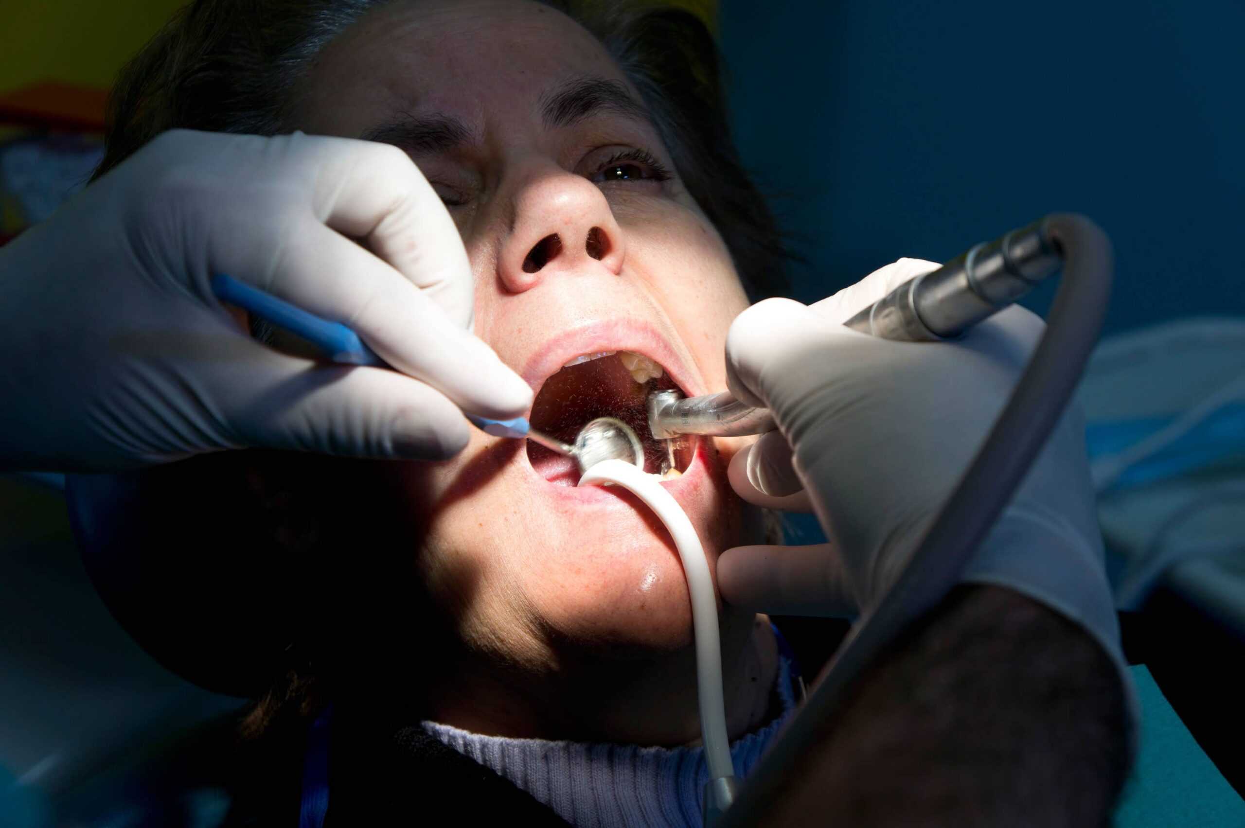 NHS dentistry is ‘gone for good’ – report
