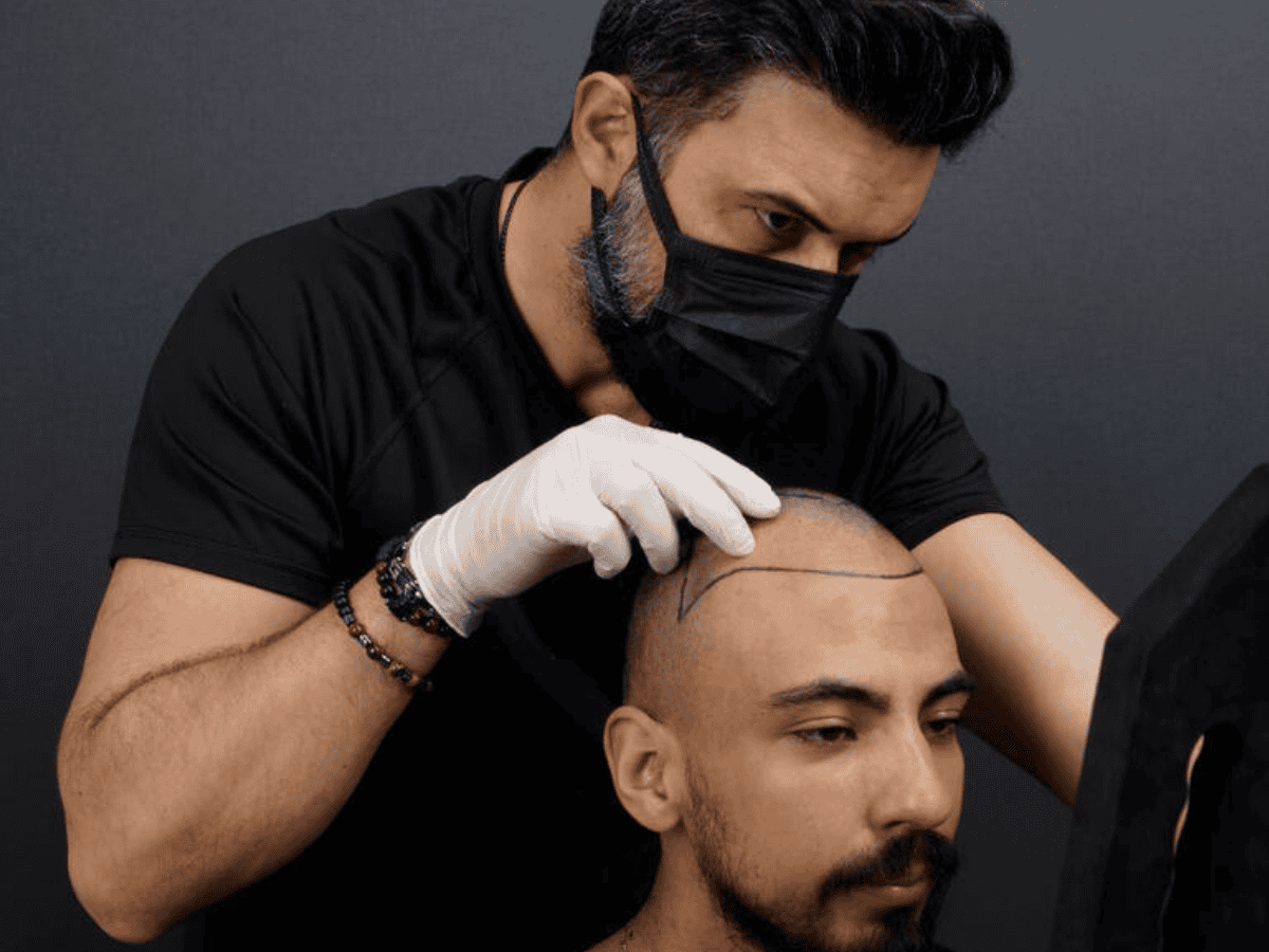 Expected to Grow Through 2024: Thousand Flock to Istanbul for Affordable Hair Transplant Turkey Cost